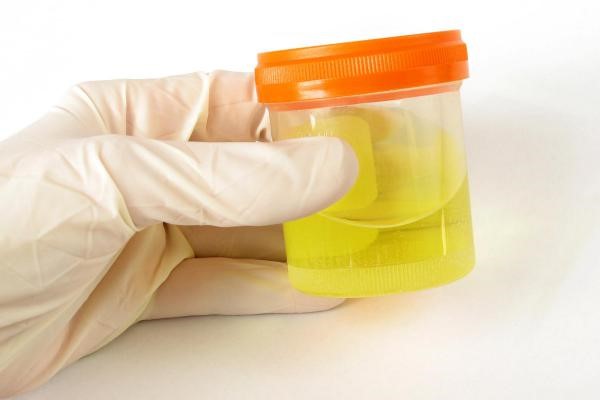 Synthetic Urine Test Kit Stagecrest Raleigh NC